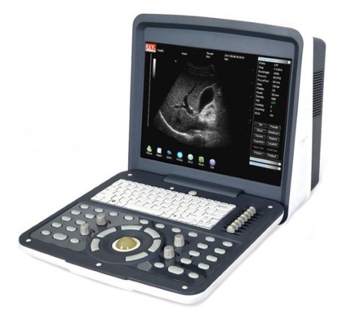 Acuvista RS880d 15" Acuvista RS880d 15"