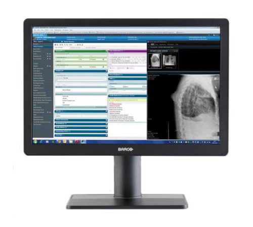 Barco Eonis 24" (MDRC-2324) Barco Eonis 24" (MDRC-2324)