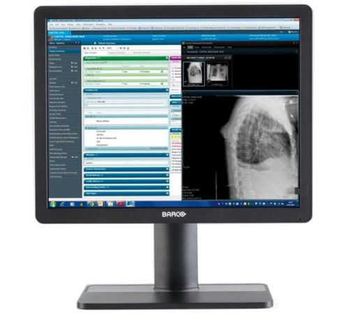 Barco Eonis 21" (MDRC-2321) Barco Eonis 21" (MDRC-2321)