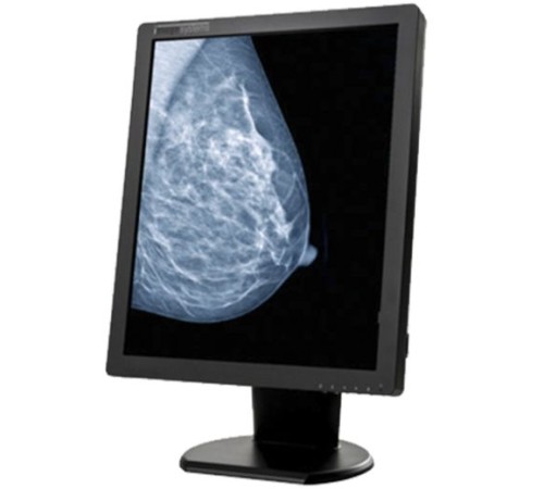 Double Black Imaging Image Systems 5MP Grayscale Diagnostic Display (M5MPNT) Double Black Imaging Image Systems 5MP Grayscale Diagnostic Display (M5MPNT)
