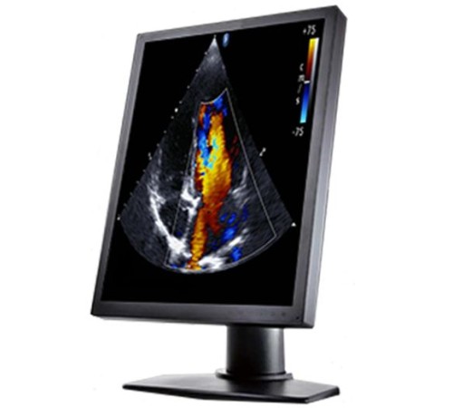 Double Black Imaging 2MP Color Clinical LCD Double Black Imaging 2MP Color Clinical LCD