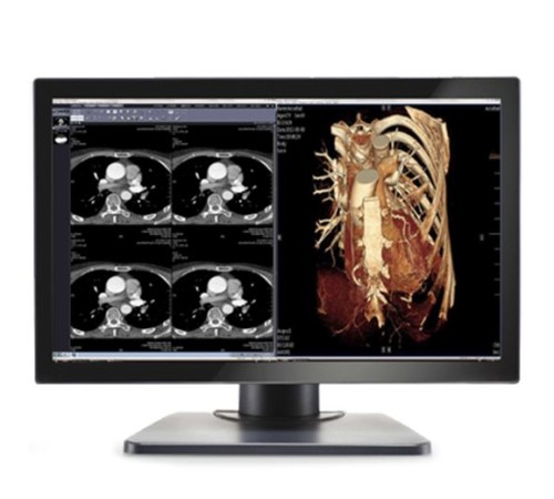 Double Black Imaging Image Systems Gemini 4MP Large Format Display Double Black Imaging Image Systems Gemini 4MP Large Format Display